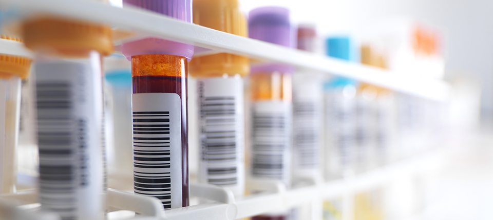 Blood samples in a test tube rack.